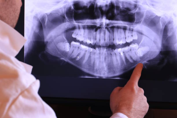 Best 24-Hour Emergency Dentist in Grapeland, TX